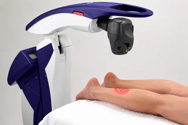MLS Laser Therapy for Pain Relief